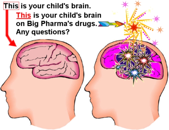 This is your child's brain. This is your child's brain on Big Pharma's drugs. Any questions? This is your child's brain. This is your child's brain on Big Pharma's drugs. Any questions?