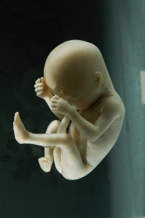 The fundamentalists say no terminating of pregnancies, because you might infringe on the rights or the soul of a zygote or tiny not-yet-human fetus! The fundamentalists say no terminating of pregnancies, because you might infringe on the rights or the soul of a zygote or tiny not-yet-human fetus!
